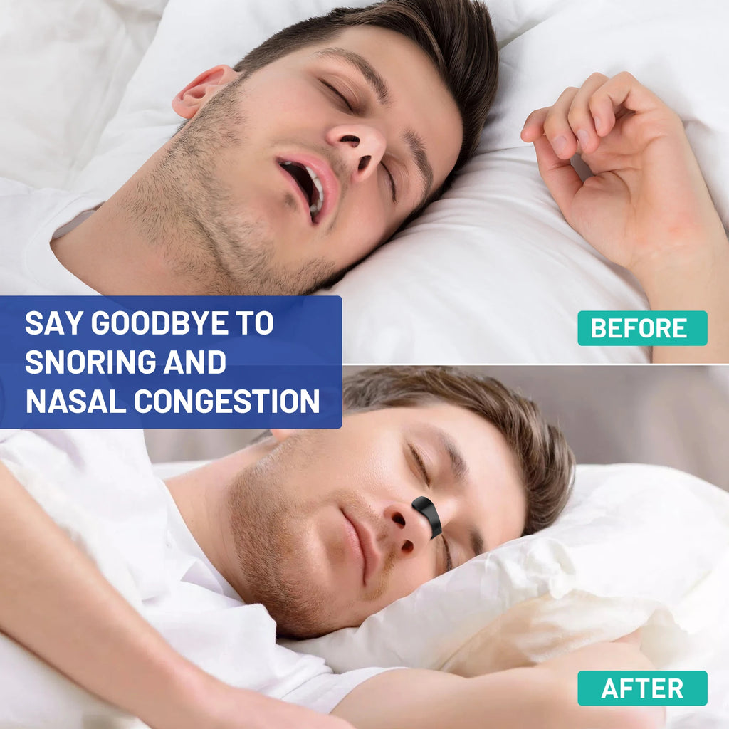 AsapCare 30-Day Sleep & Sport Nasal Dilator Starter Kit